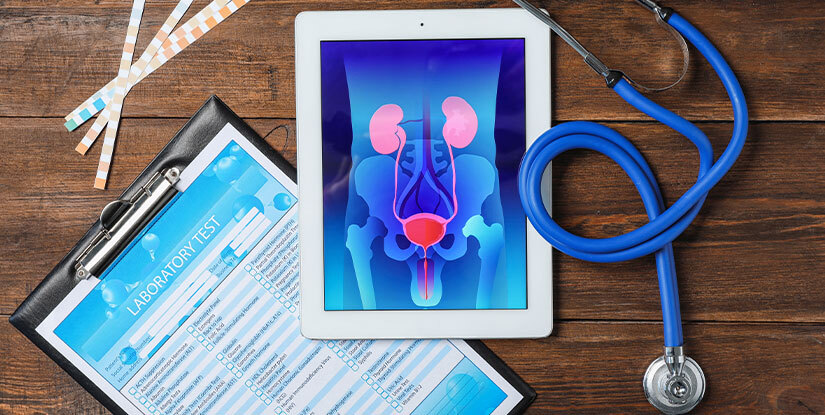 Prostate Screenings for Early Cancer Detection in Men